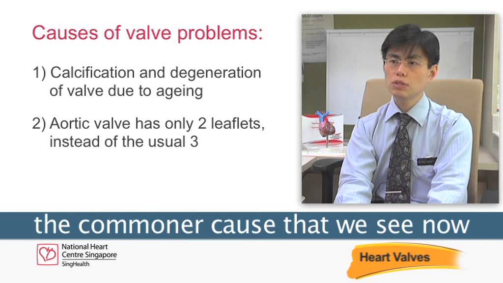 Common Causes and Problems with Heart Valves