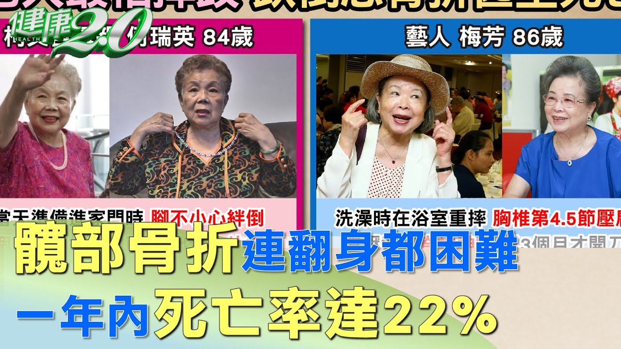 髖部骨折連翻身都困難 一年內死亡率達22% 健康2.0