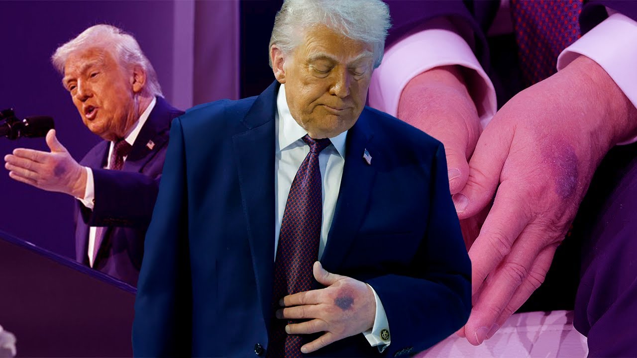 DONALD TRUMP está MURIENDO - ¿Qué Enfermedad tiene? - MAGNUS MEFISTO