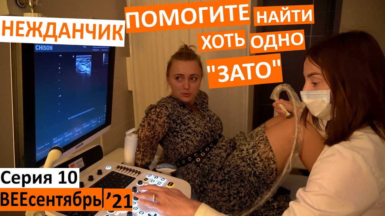 10 серия / прошла узи, а там сюрприз.. / где искать Зато? / узд суставов / передача от папы / агапіт