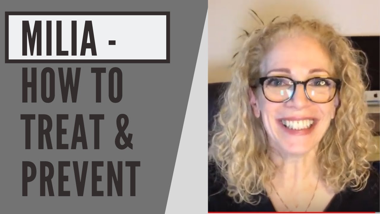 HOW TO PREVENT MILIA & HOW TO TREAT THEM NATURALLY!