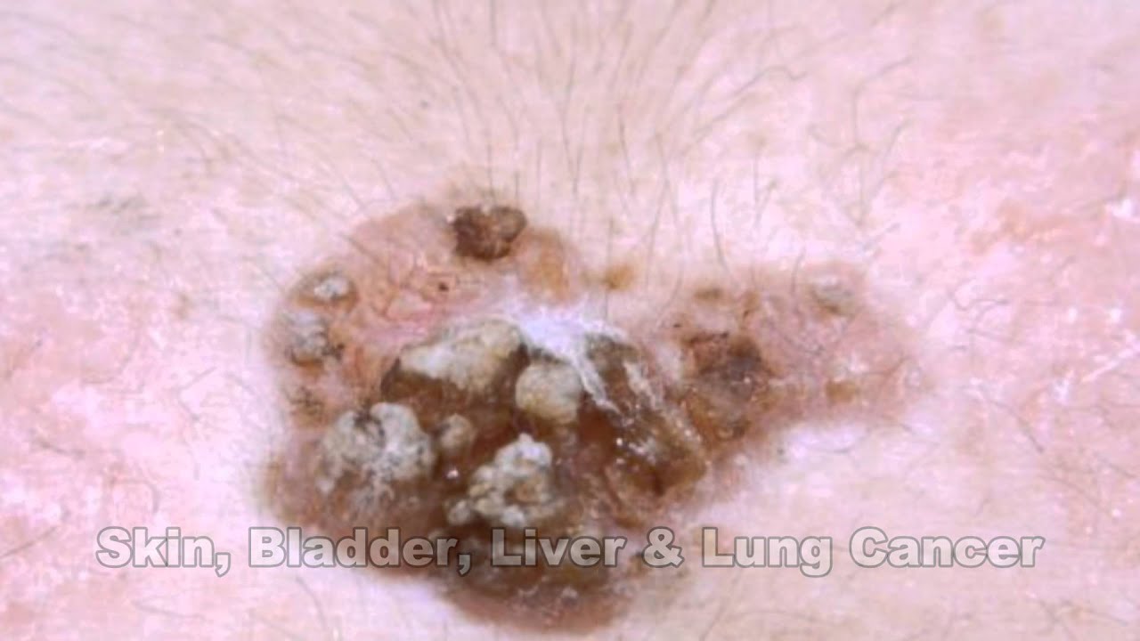 Arsenic Exposure Risks: At Home & Work