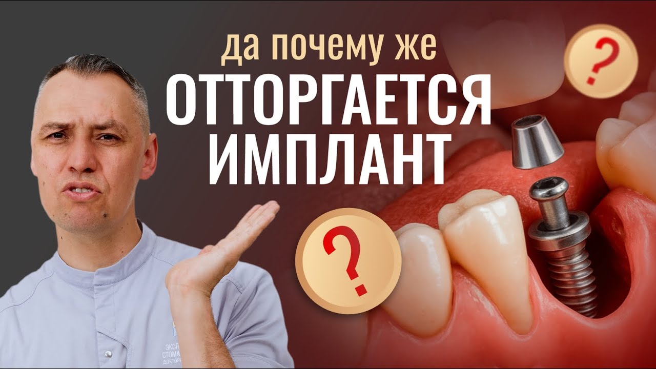 ИЗ ЗА ЧЕГО НЕ ПРИЖИВАЮТСЯ ИМПЛАНТЫ? 🤔