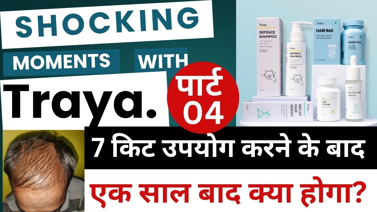 Part-4🎯 Traya hair kit review after 7 kits used |  Traya hair loss solution, review will continue 1y