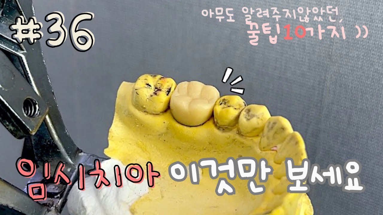 임시치아 빠르게 잘 깎는법 ? 어렵지 않아요 :) &bull; 36번 임시치아 &bull; 쉽게 완벽정복 가능