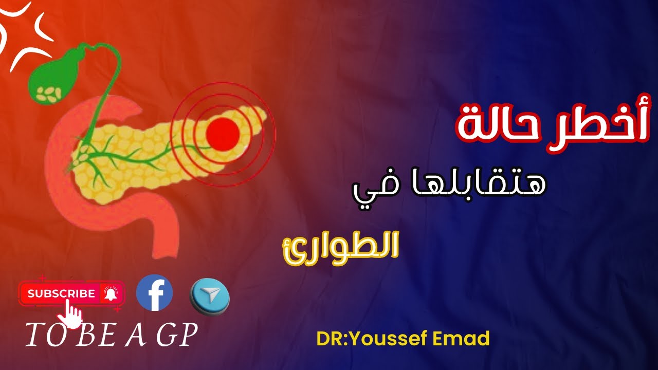 Acute pancreatitis/ الحالة اللي بتخوف اي دكتور