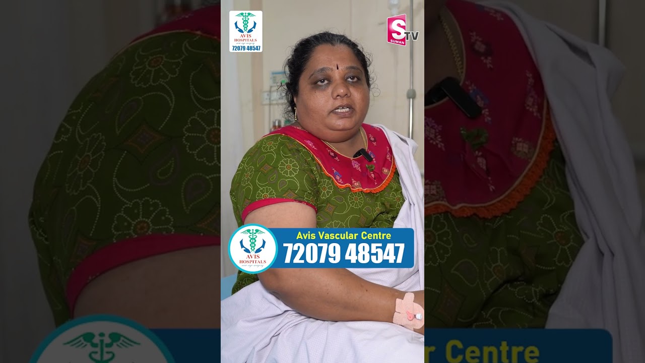 Varicose Veins Treatment In Telugu | Avis Hospital | #sumantvvijayawada