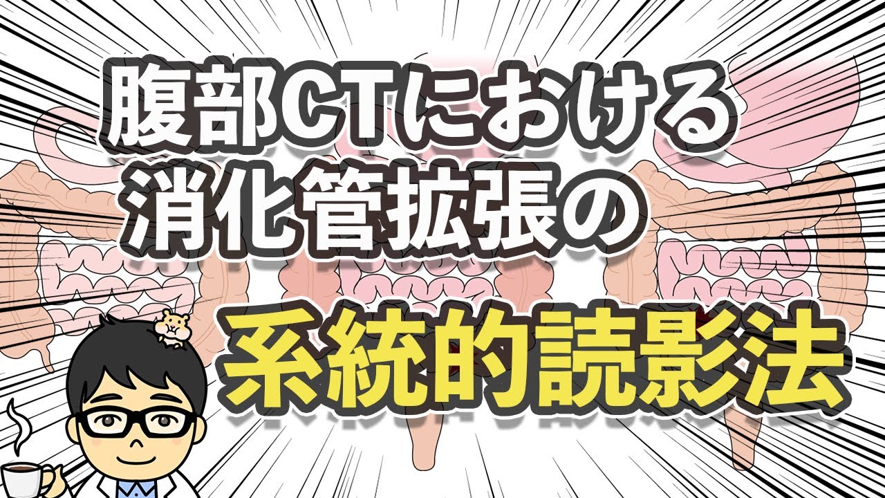 腹部CTにおける消化管拡張の系統的読影法 #概要欄に無料講座あり。