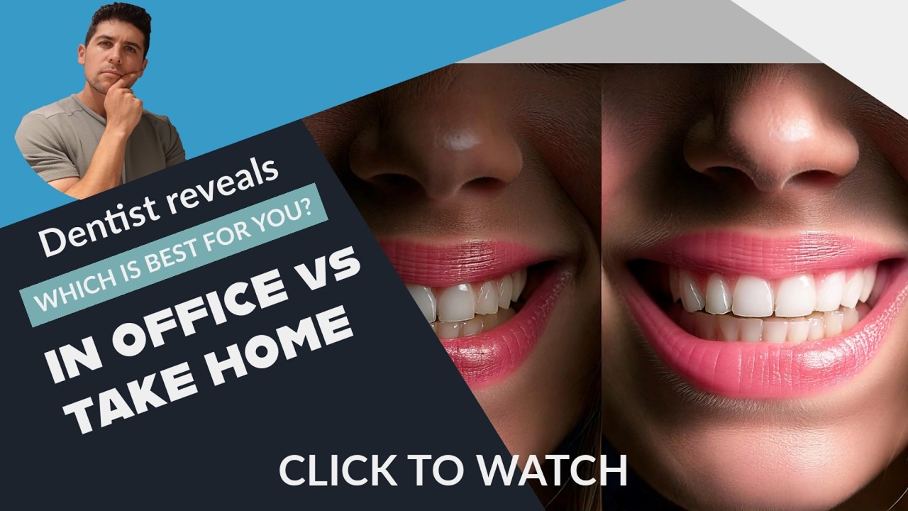 Take-Home vs. In-Chair Whitening: Which is Best for You?