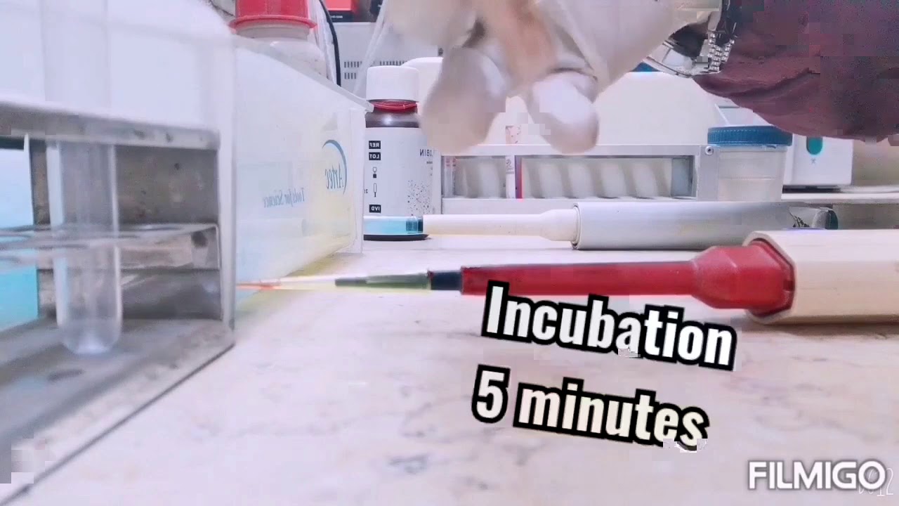 الطريقة العمليه لتحليل الهيموجلوبين HB%/ Hemoglobin  في المعمل  بطريقة مانيوال سريعة و سهلة