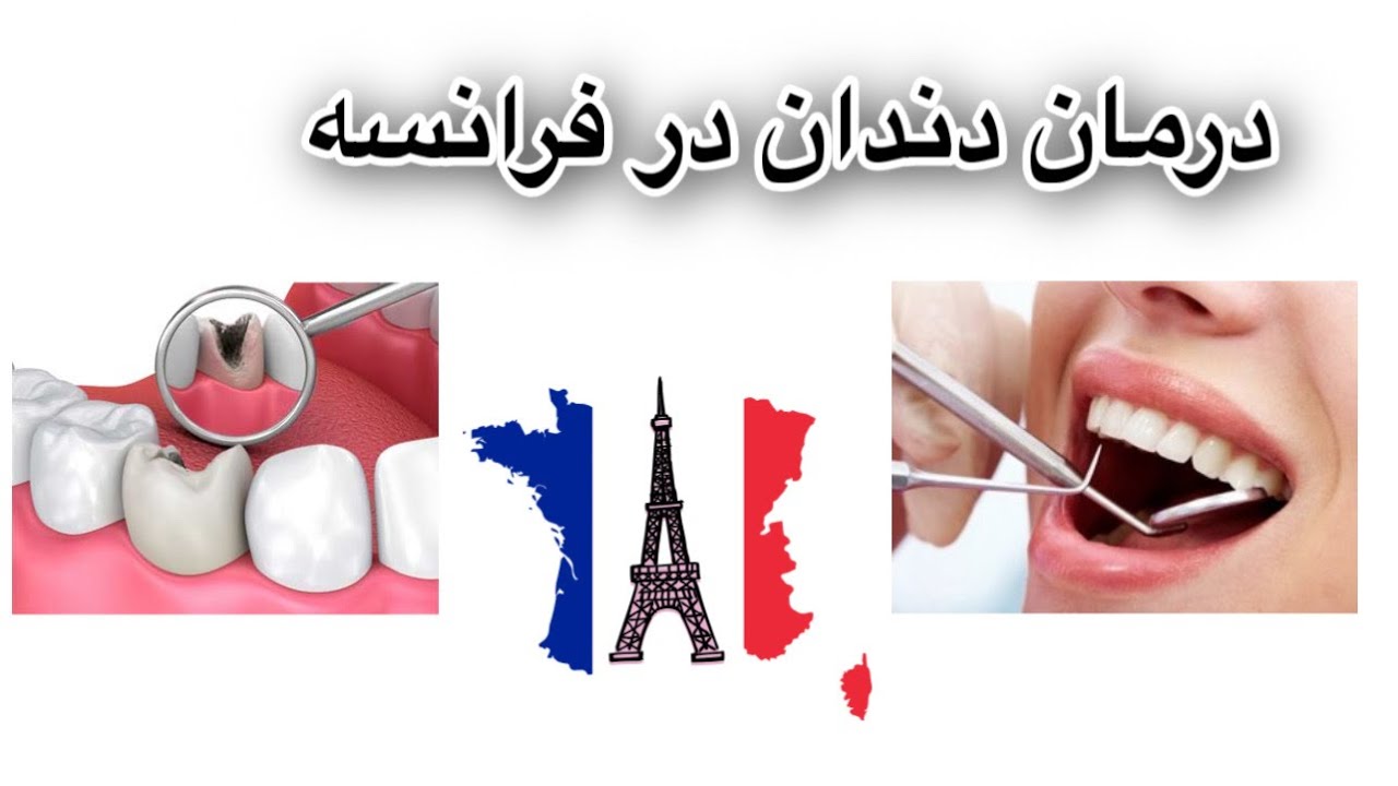 درمان دندان در فرانسه