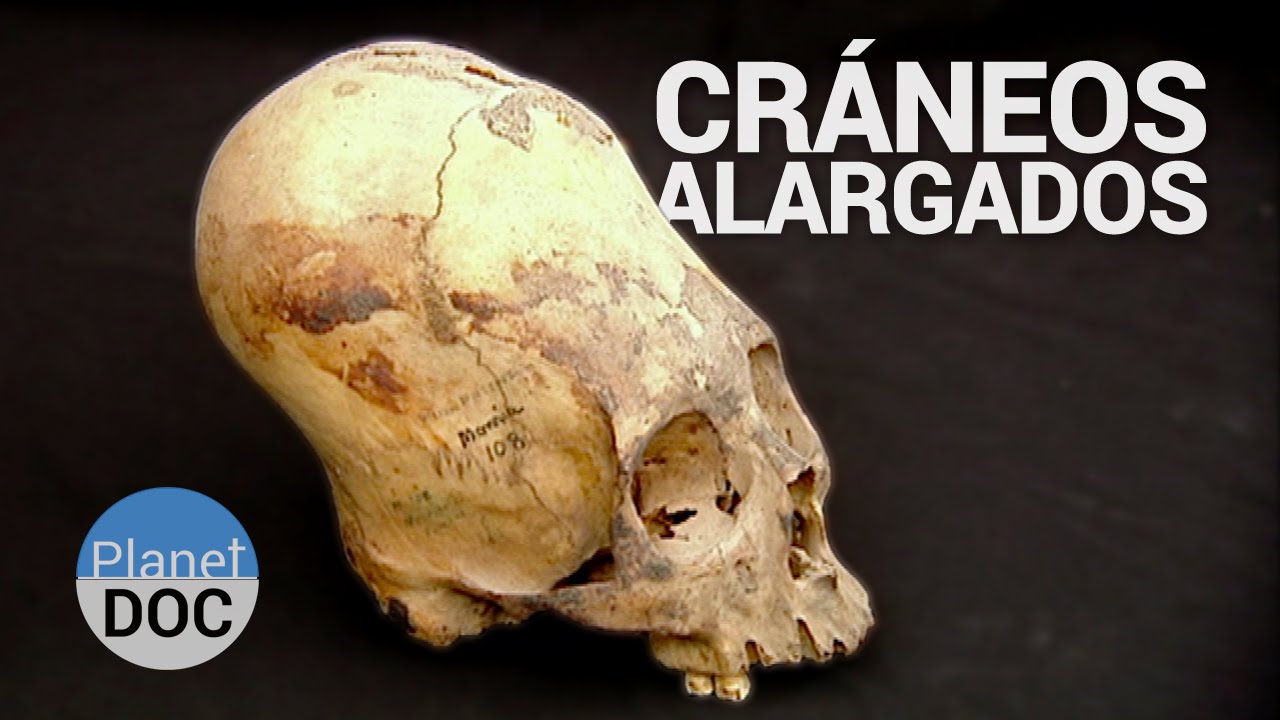 Cráneos Alargados. Precursores del Inca | Historia - Planet Doc