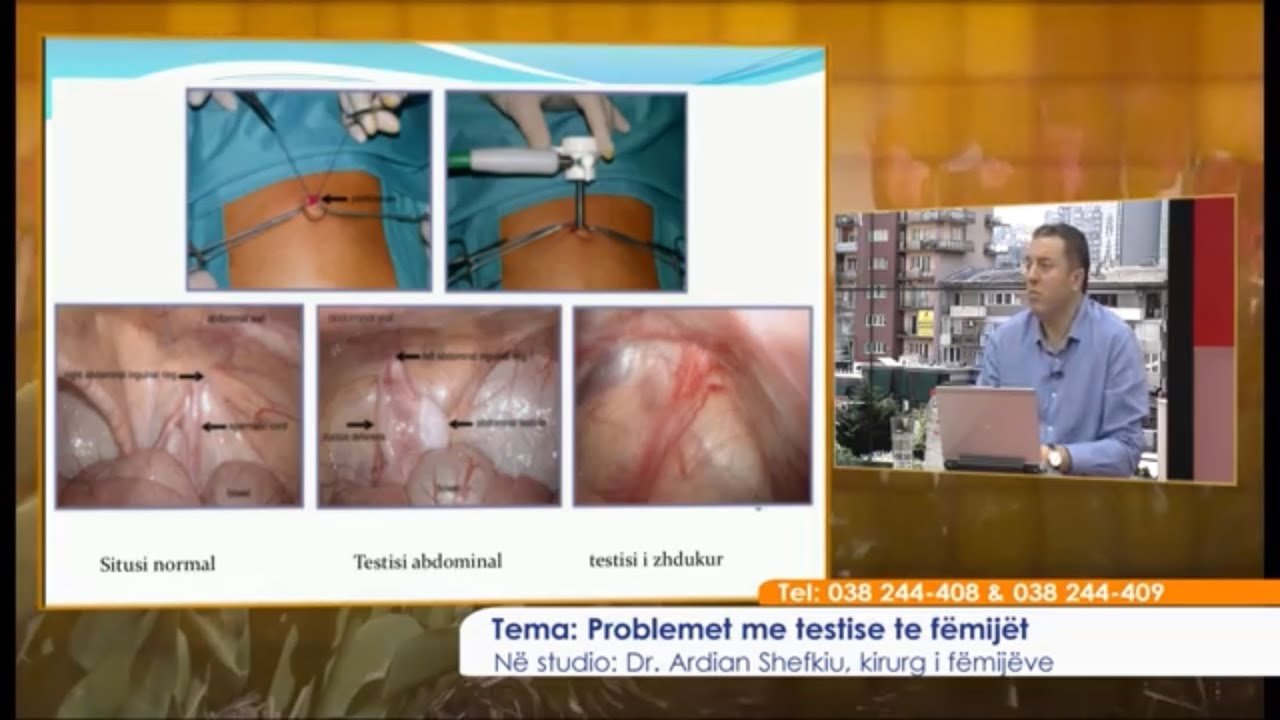Mjeku ne studio - Problemet me testise te fëmijët  05.06.2019