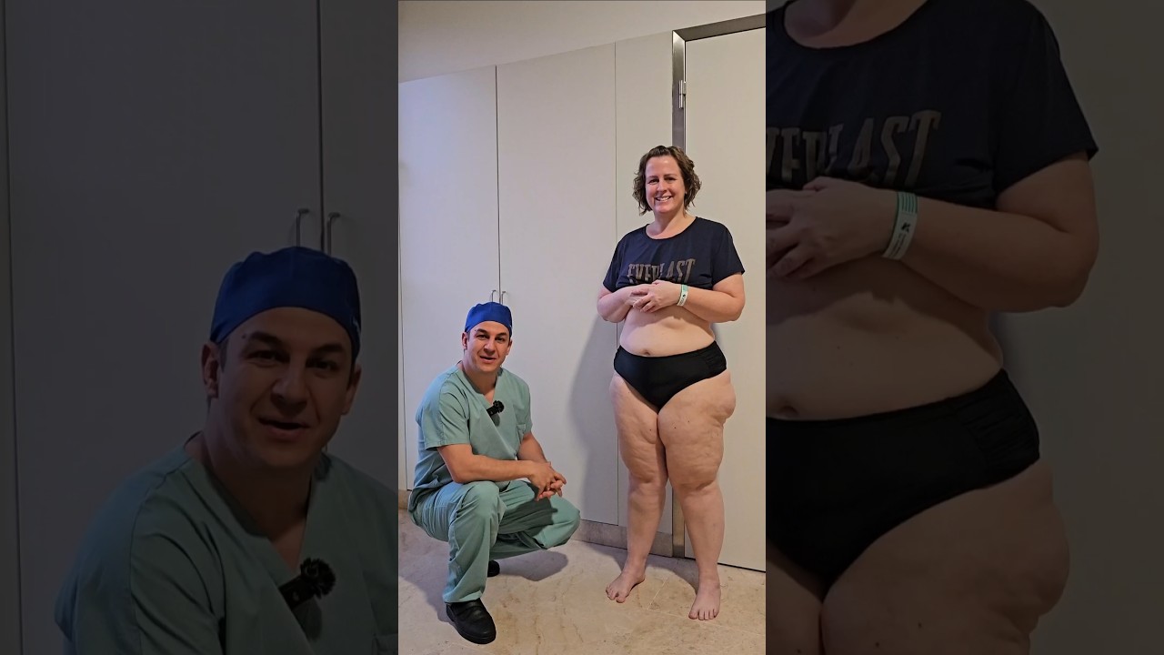 How to DIAGNOSE LIPEDEMA! #lipedema #lipoedema #lipedemaawareness