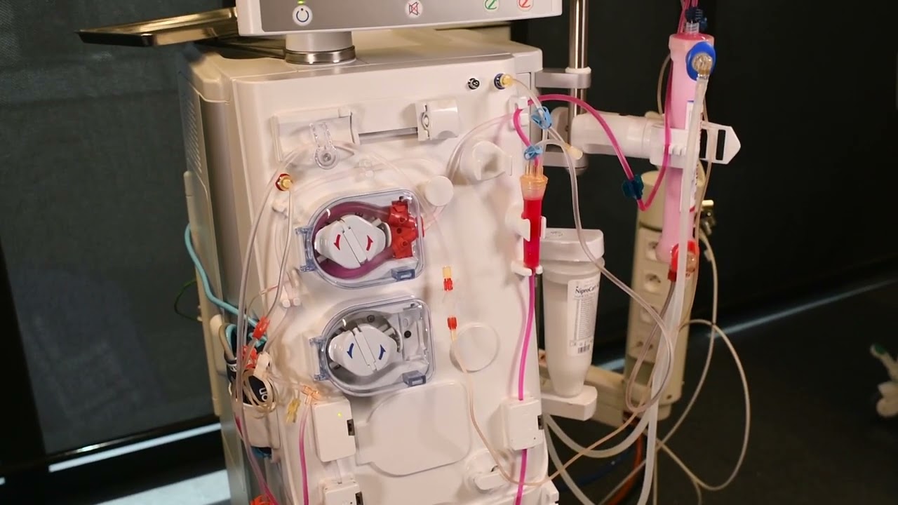 How to perform a bloodline change on Surdial X during therapy