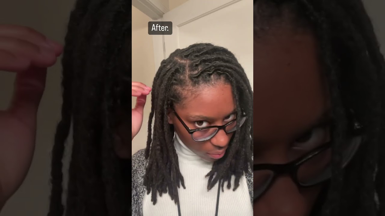 Before & After- Loc Retwist Results 2 Yr.  & 7 Months