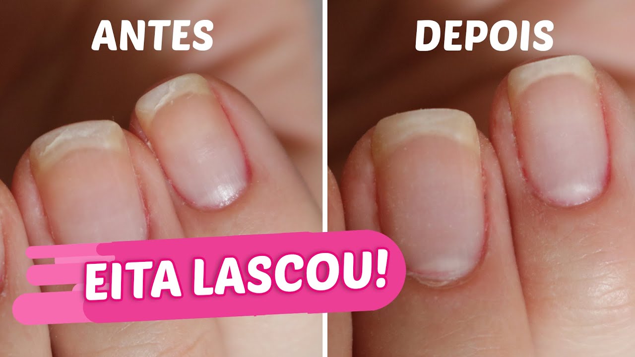 Unhas lascadas: como prevenir e consertar - Vício de Menina