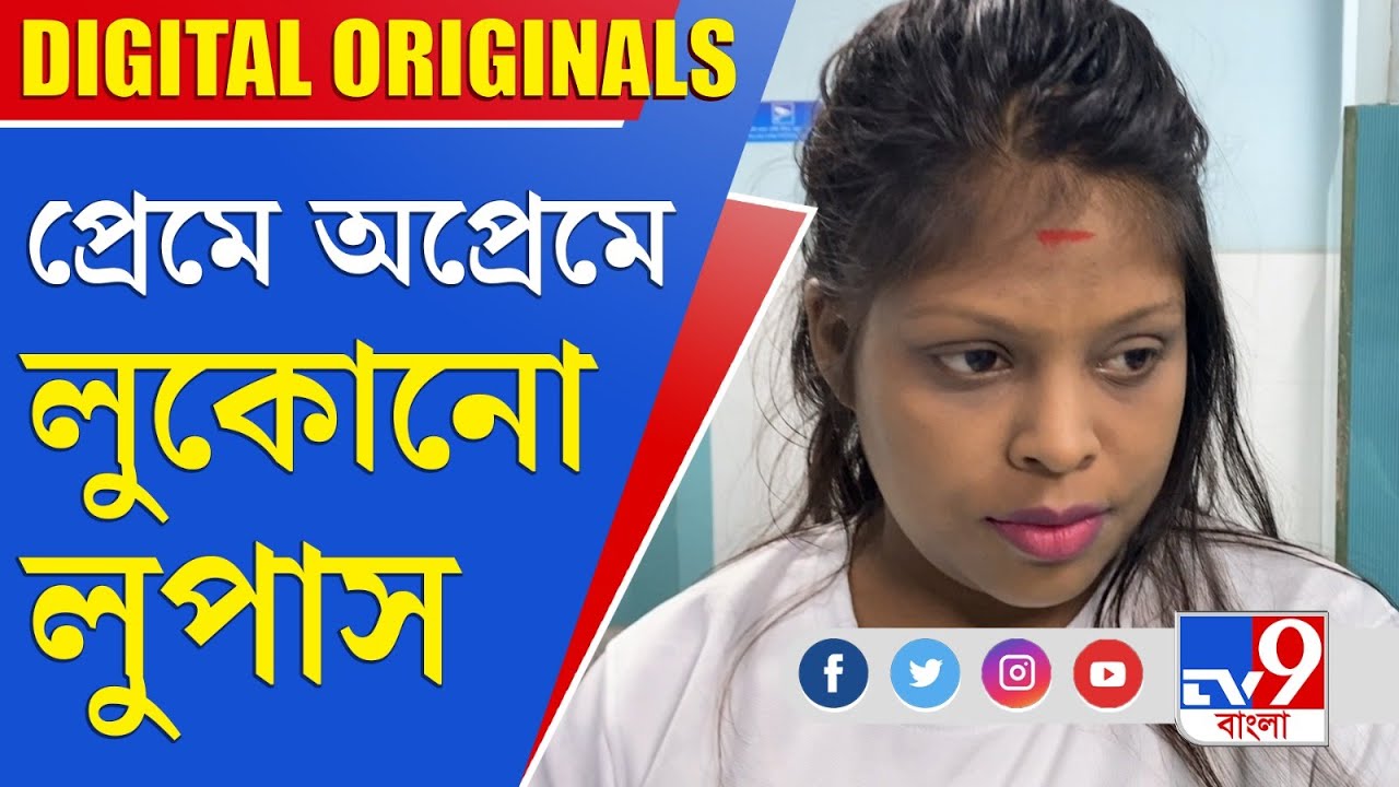 Lupus: লুপাসে রোগের চেয়েও বেশি কষ্টকর নিকটজনের অবহেলা