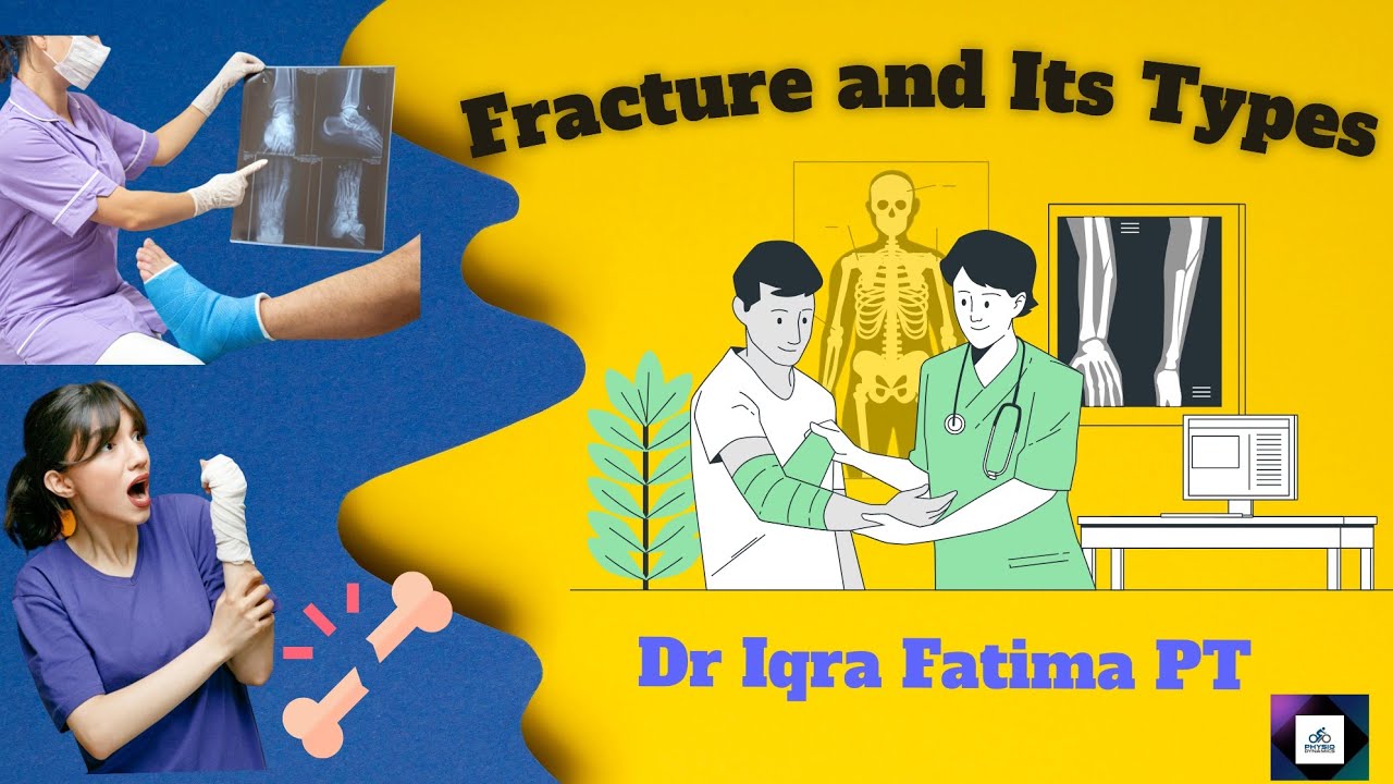 Fracture And Its Types | Def | Risk Factors | #biomechanics #therapeutic #exercises