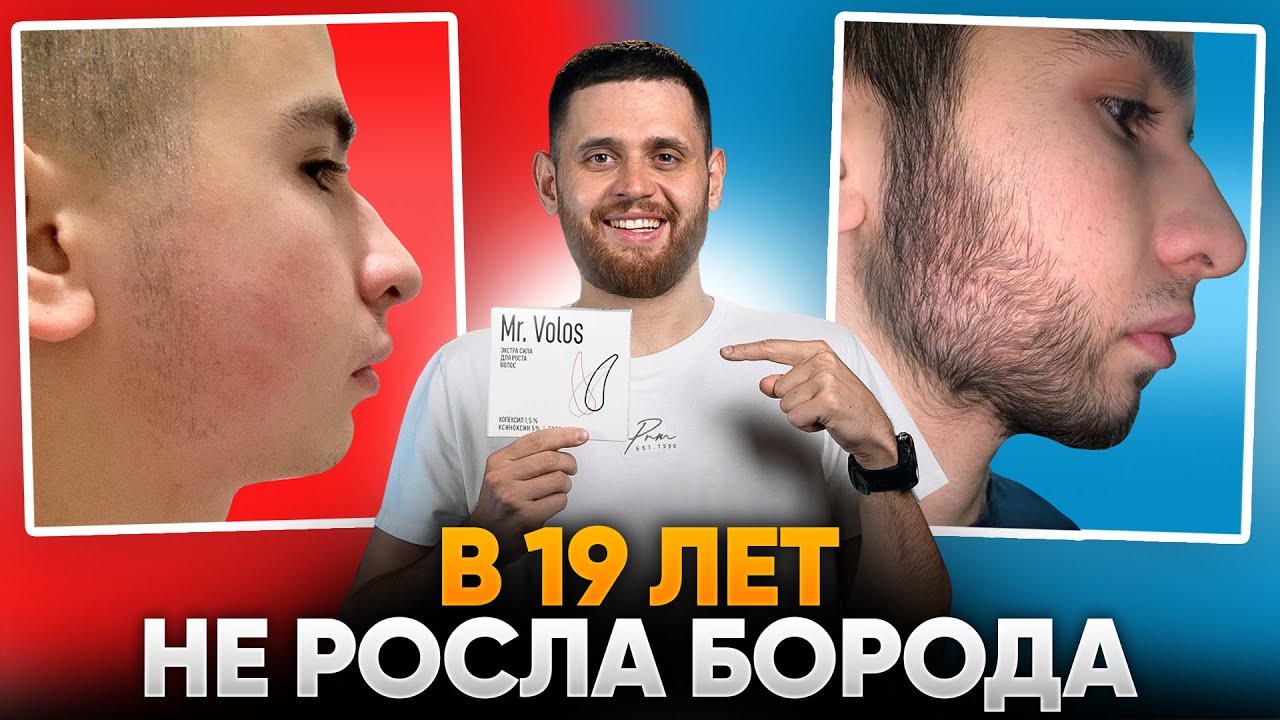 БОРОДА С НУЛЯ ВСЕГО ЗА 4 МЕСЯЦА / Результаты mr.Volos