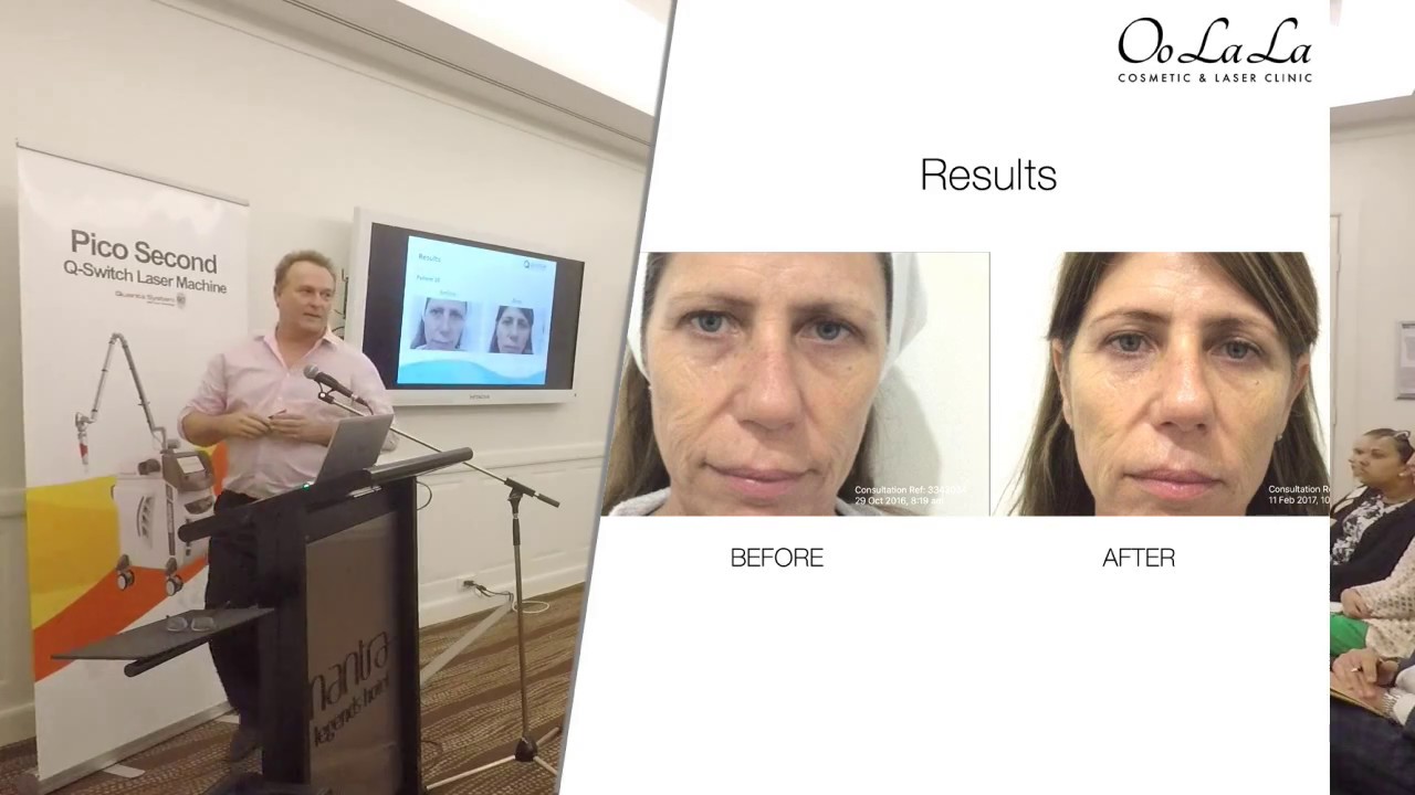 Dr Mark Jeffery Presentation on YouLaser