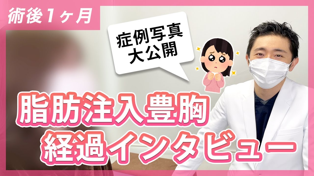 脂肪豊胸でバストアップ！手術を受けた患者様にインタビュー【コンデンスリッチ2回目】