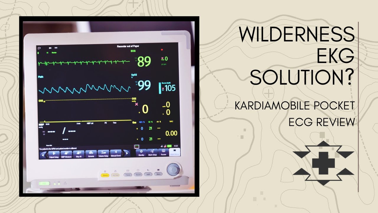 Wilderness EKG? KardiaMobile Pocket ECG review.