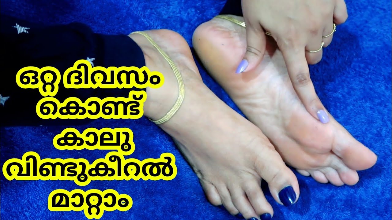 കാലു വിണ്ടുകീറൽ  ഒറ്റ ദിവസം കൊണ്ട് മാറ്റാം / Live Result../ Cracked heels/feet care/ foot care