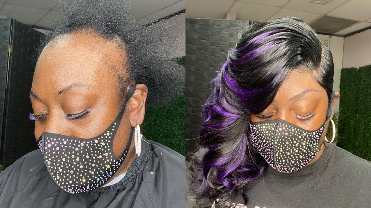 She was tired of hiding her alopecia with  wigs.