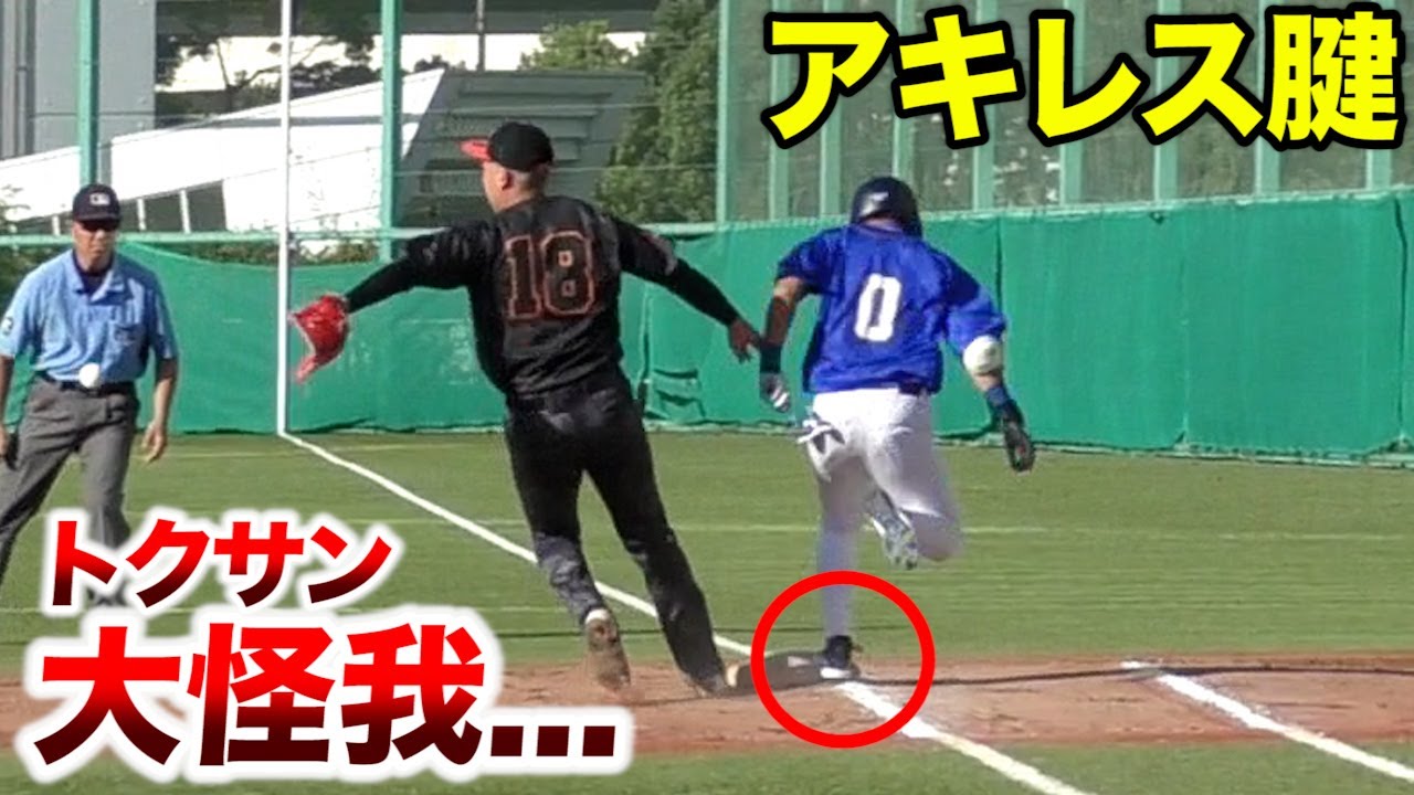 アキレス腱が限界！走ると激痛…トクサンが大怪我。