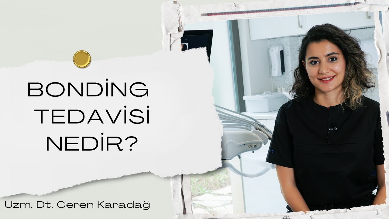 Bonding İşlemi Nedir? Kompozit laminalar ne zaman uygulanabilir?