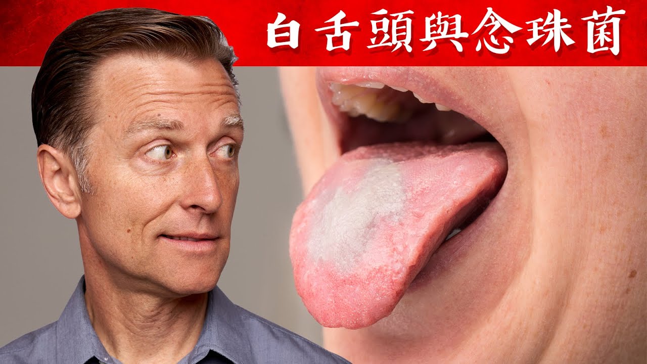 白舌頭(鵝口瘡)吃太多碳水餐、念珠菌太多！自然療法,柏格醫生 Dr Berg
