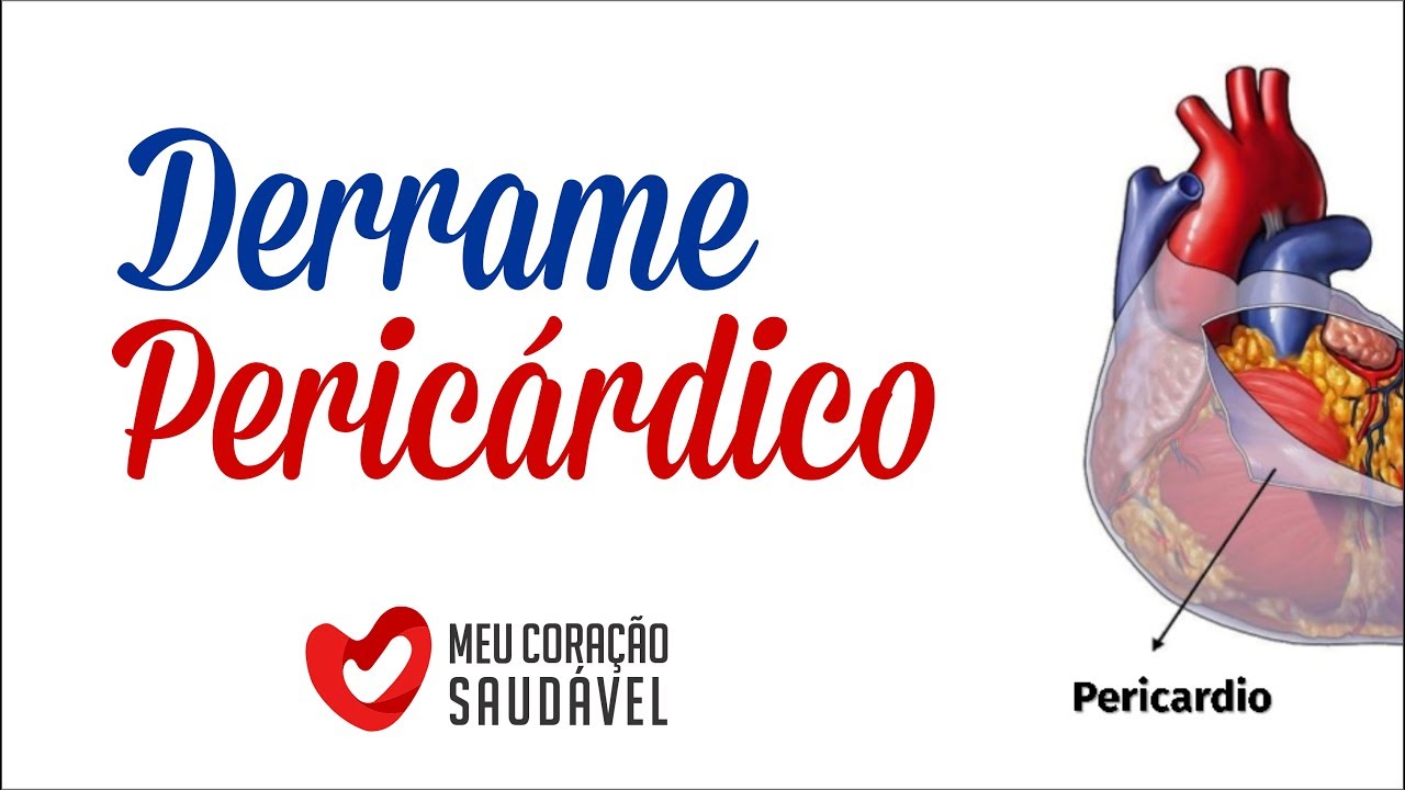 Derrame pericardico: &eacute; grave? Quais s&atilde;o as causas?