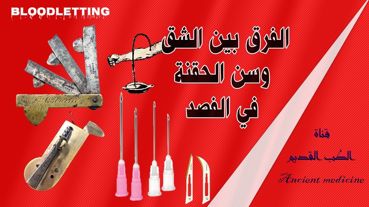 ما الفرق بين الشق وسن الحقنه في الفصد؟ وأيهما افضل؟
