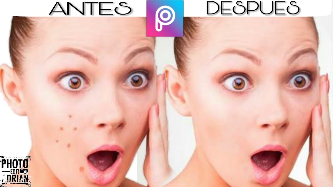 Como Quitar manchas y puntos negros en tus fotos con PicsArt | SOYPHOTO