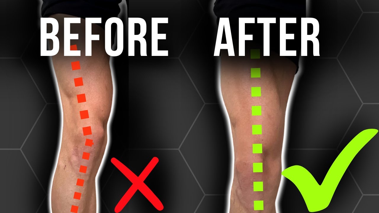 Unf*ck Your Knee with These 2 Drills | Fix Inner and Outer Knee Pain