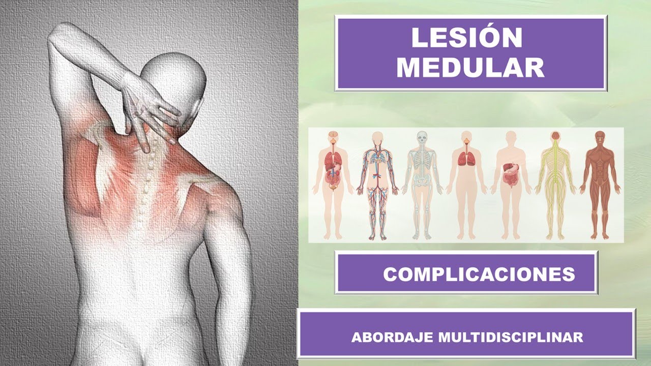 LESI&Oacute;N MEDULAR, COMPLICACIONES Y ABORDAJE