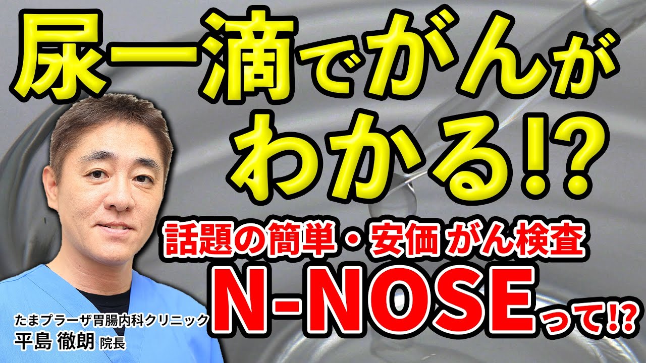 尿一滴で【がん】がわかる!?    N-NOSEっていうがん検査はどうなの？　教えて平島先生 No89