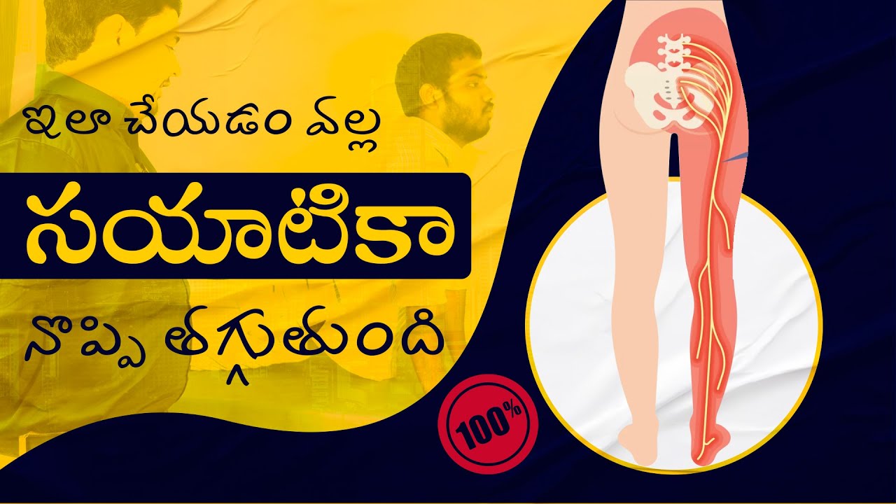 Effective Exercises for Sciatica Relief - Alleviate Pain and Improve Mobility