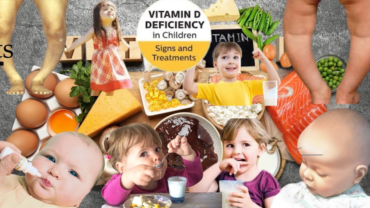 KORINSHAHA CARUURTA VITAMIN D🤱MUHIIM MIYA IN LASIIYO CARUURTA  IYO WAQTIGA LAGU BILAWO  KAFA,IDEYSO🥛