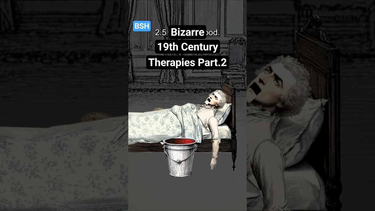 Bizarre Medical Treatment in the 19th Century Part. 2