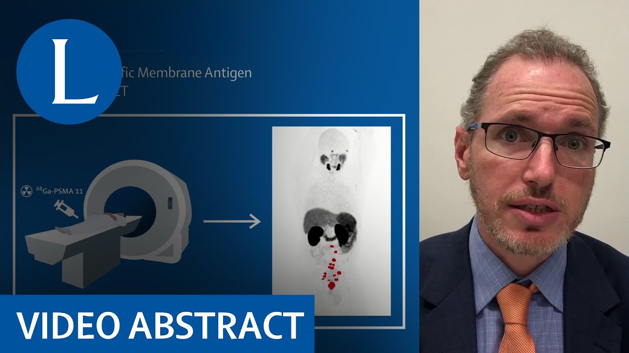 PSMA PET-CT in patients with high-risk prostate cancer