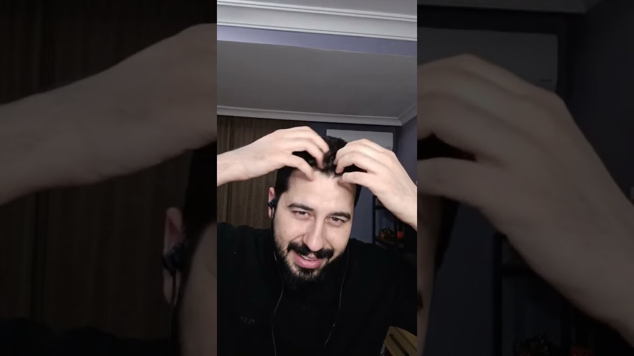 إزالة القشور ومواضيع اخرى