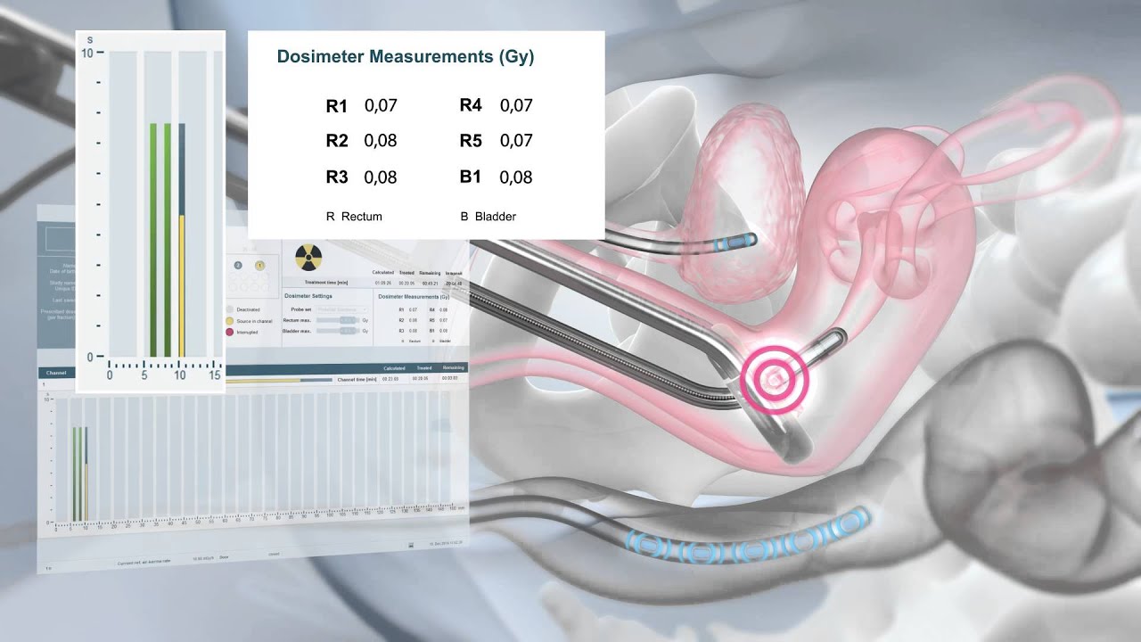 Eckert & Ziegler BEBIG: The SagiNova® Afterloader for HDR Brachytherapy