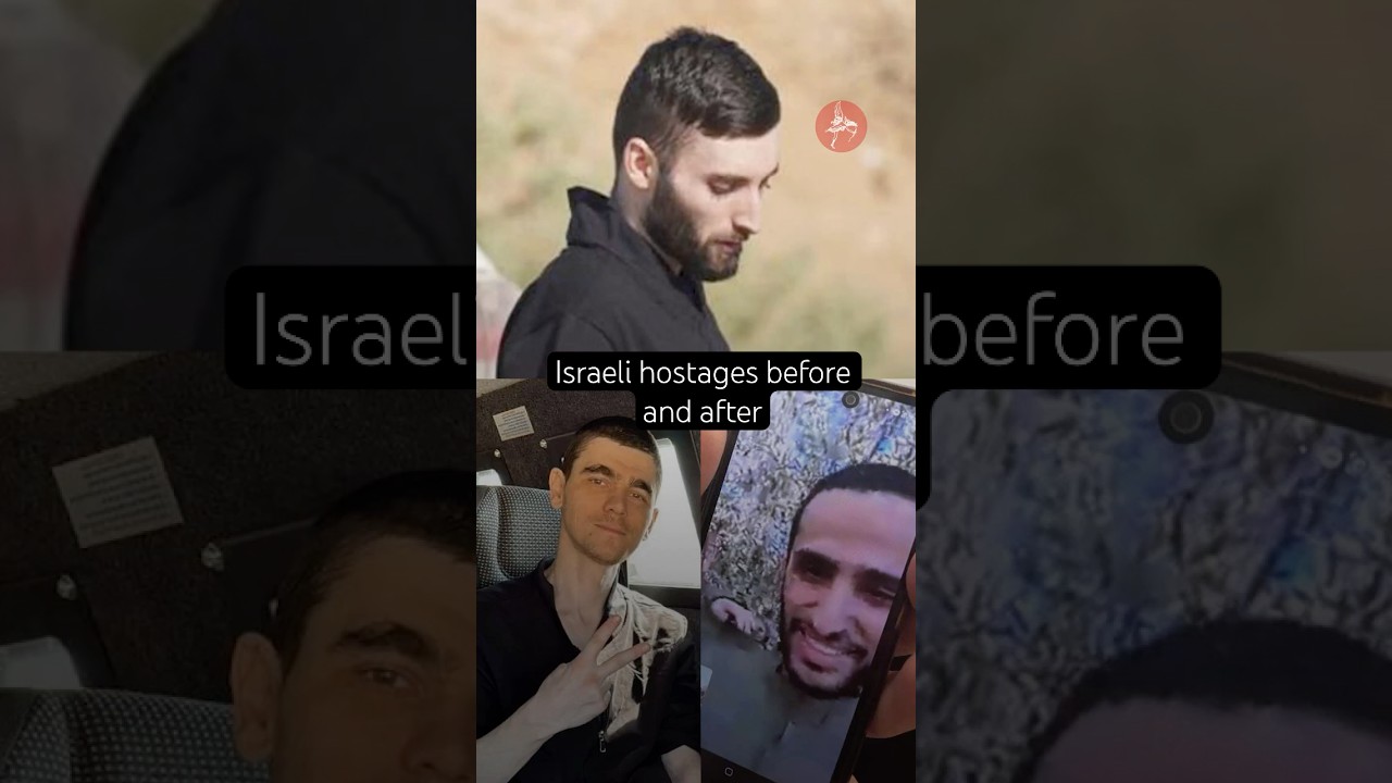 Before and after images of Israeli hostages released from captivity by #hamas