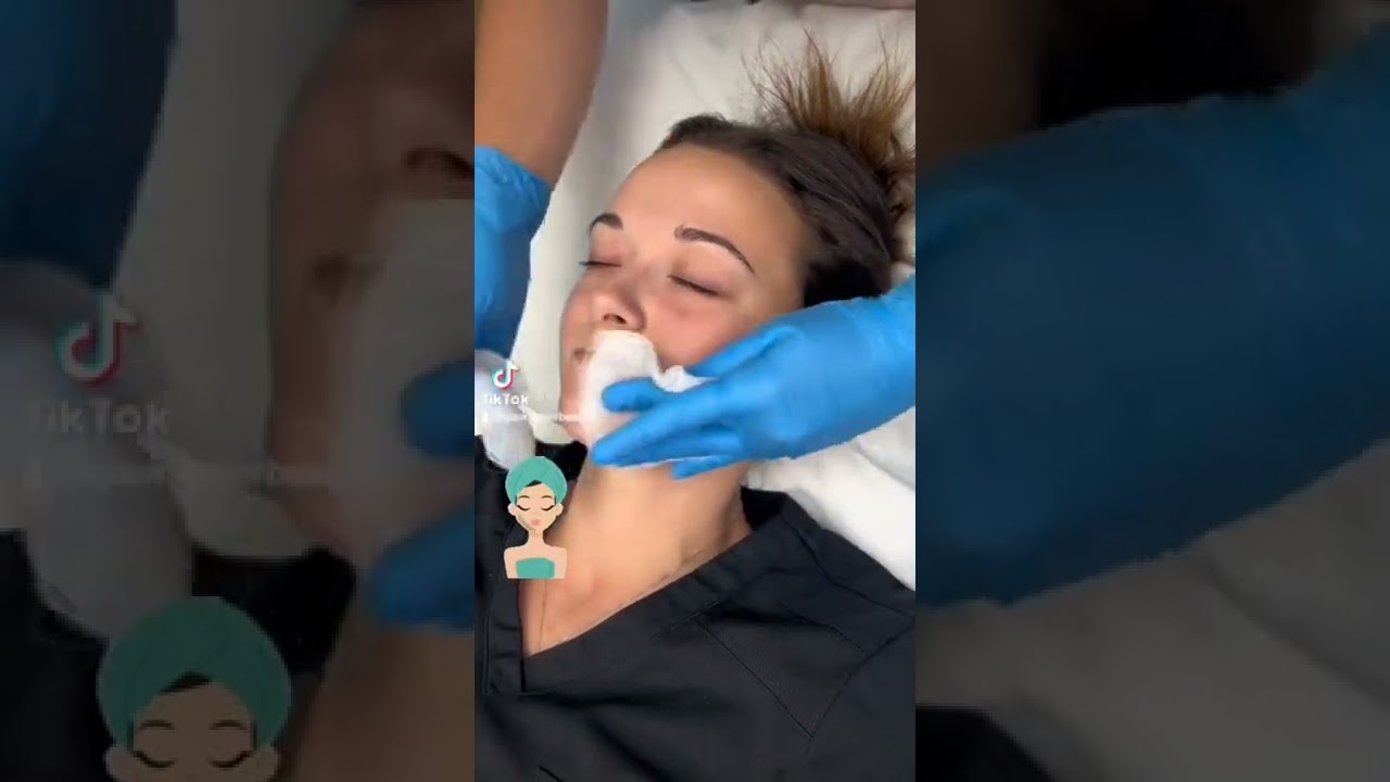 Chemical Peel Steps 