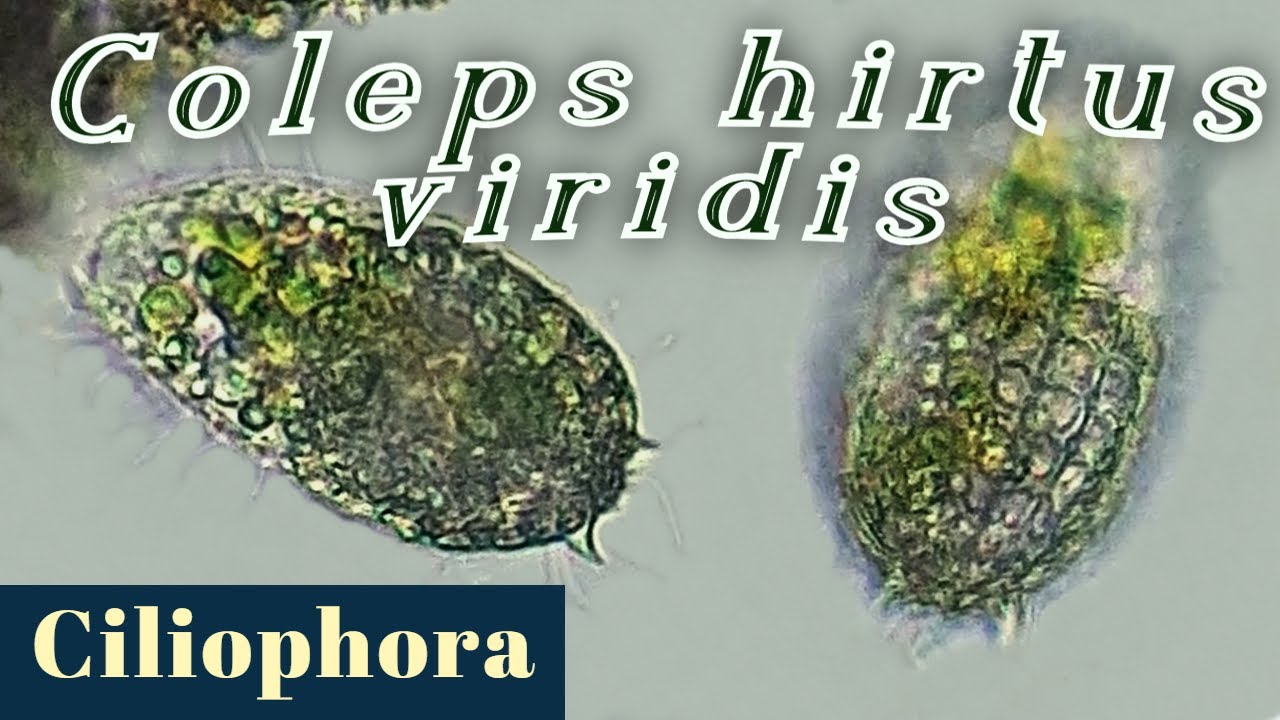 Coleps hirtus viridis (Ciliophora = Ciliate)