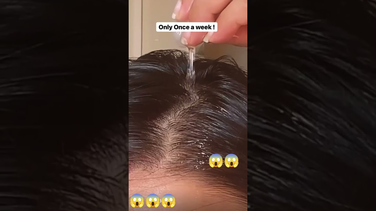 How to use  vitamin E capsule for coconut oil !! Hair Growth! Hair fall l rough  & frizzy hair