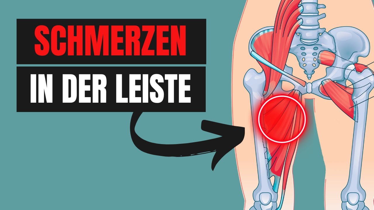 Schmerzen in der Leiste (Ursache, Diagnose, Übungen & Therapiepläne)