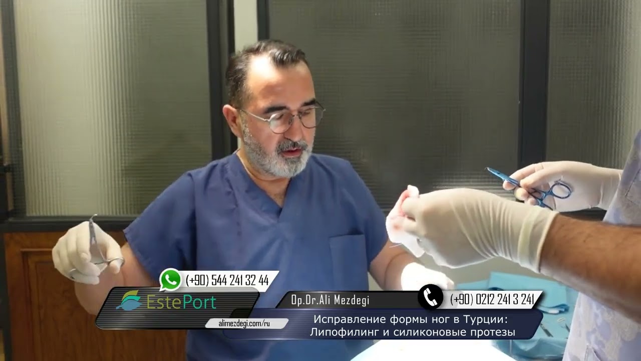 Исправление формы ног в Турции: Липофилинг и силиконовые протезы